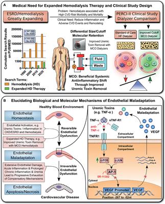 Expanded Hemodialysis Therapy Ameliorates Uremia-Induced Systemic Microinflammation and Endothelial Dysfunction by Modulating VEGF, TNF-α and AP-1 Signaling